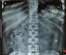 Drug-Packer X-Ray.jpg