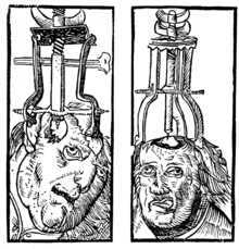 Peter Treveris - engraving of Trepanation for Handywarke of surgeri 1525.png